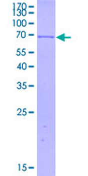 HLA-B (Human) Recombinant Protein (P01)