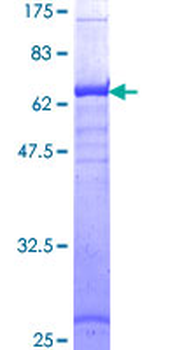 HLA-A (Human) Recombinant Protein (P01)