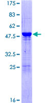 HIP2 (Human) Recombinant Protein (P02)