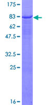 SERPIND1 (Human) Recombinant Protein (P01)