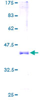 HBA2 (Human) Recombinant Protein (P01)