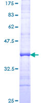 HBA1 (Human) Recombinant Protein (Q01)