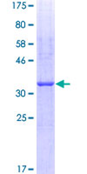 HAS2 (Human) Recombinant Protein (Q01)