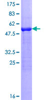 HAGH (Human) Recombinant Protein (P01)