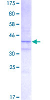 H2AFX (Human) Recombinant Protein (P01)
