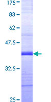 GUCY2C (Human) Recombinant Protein (Q01)