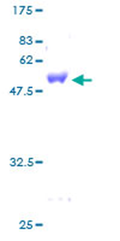 GSTZ1 (Human) Recombinant Protein (P01)