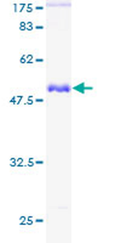 GSTT1 (Human) Recombinant Protein (P01)