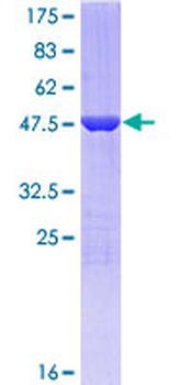 GSTP1 (Human) Recombinant Protein (P01)