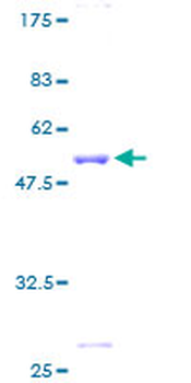 GSTA4 (Human) Recombinant Protein (P01)