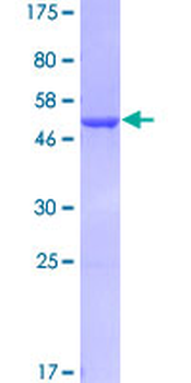 GSTA3 (Human) Recombinant Protein (P01)