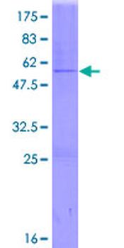 GSTA2 (Human) Recombinant Protein (P01)
