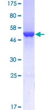 GSTA1 (Human) Recombinant Protein (P01)