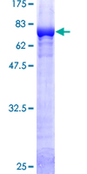 GSS (Human) Recombinant Protein (P02)