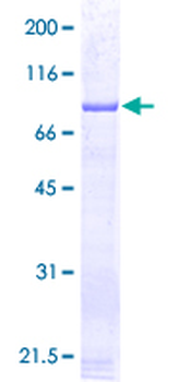 GSS (Human) Recombinant Protein (P01)