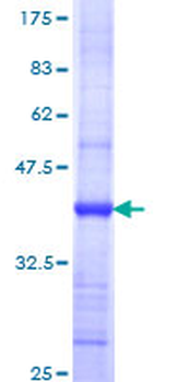 GSPT1 (Human) Recombinant Protein (Q01)