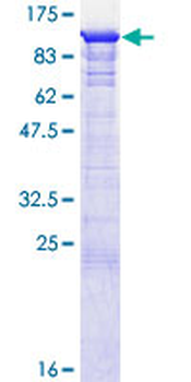 GSPT1 (Human) Recombinant Protein (P02)