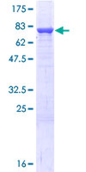 PDIA3 (Human) Recombinant Protein (P01)