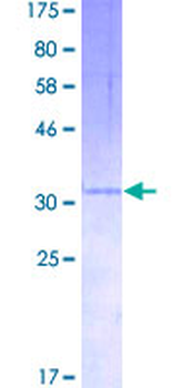 CXCL3 (Human) Recombinant Protein (P01)