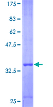 CXCL2 (Human) Recombinant Protein (P01)