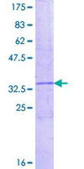 CXCL1 (Human) Recombinant Protein (P02)