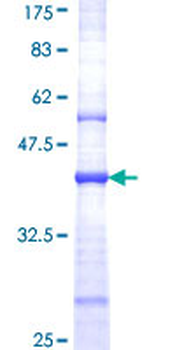 GRIN2B (Human) Recombinant Protein (Q01)
