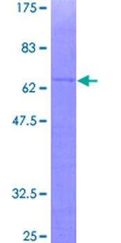 GPS2 (Human) Recombinant Protein (P01)