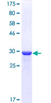 GNGT1 (Human) Recombinant Protein (P01)