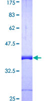 GLRX (Human) Recombinant Protein (P01)
