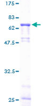GLA (Human) Recombinant Protein (P01)
