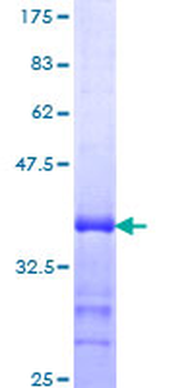 GFI1 (Human) Recombinant Protein (Q01)
