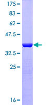 GFAP (Human) Recombinant Protein (Q01)