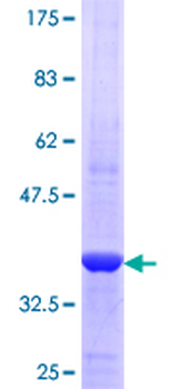 GBA (Human) Recombinant Protein (Q02)