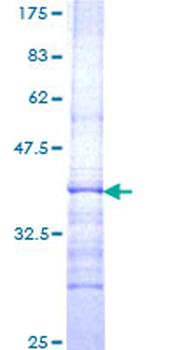 GBA (Human) Recombinant Protein (Q01)