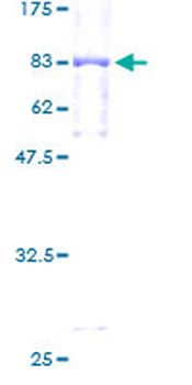 GBA (Human) Recombinant Protein (P01)