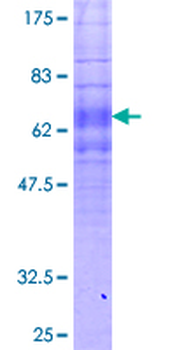 FPR1 (Human) Recombinant Protein (P01)