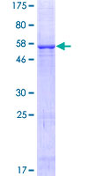 FN1 (Human) Recombinant Protein (P01)