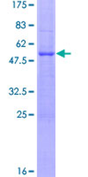 FLT3LG (Human) Recombinant Protein (P01)