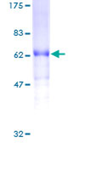 FIGF (Human) Recombinant Protein (P01)