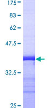 FGG (Human) Recombinant Protein (Q01)