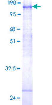 FGFR4 (Human) Recombinant Protein (P01)