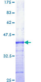 FGFR3 (Human) Recombinant Protein (Q01)