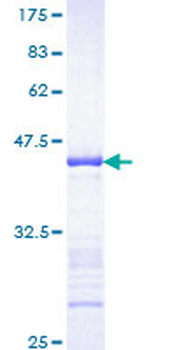 FGFR1 (Human) Recombinant Protein (Q01)
