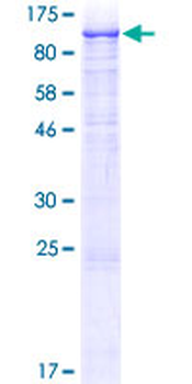 FGFR1 (Human) Recombinant Protein (P01)