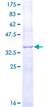 FGF2 (Human) Recombinant Protein (Q01)