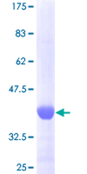 FGF1 (Human) Recombinant Protein (Q01)