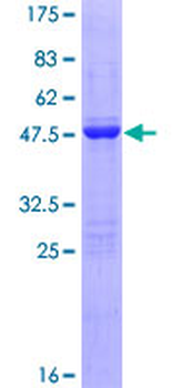 FGF1 (Human) Recombinant Protein (P01)