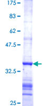 FDXR (Human) Recombinant Protein (Q01)