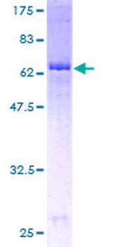 FDFT1 (Human) Recombinant Protein (P01)