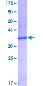 FCGRT (Human) Recombinant Protein (Q01)